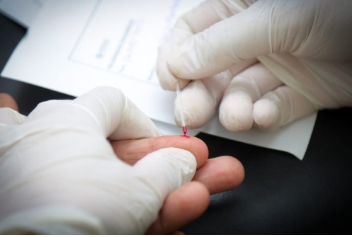 Este viernes habrá testeos de HIV, Hepatitis C y Sífilis